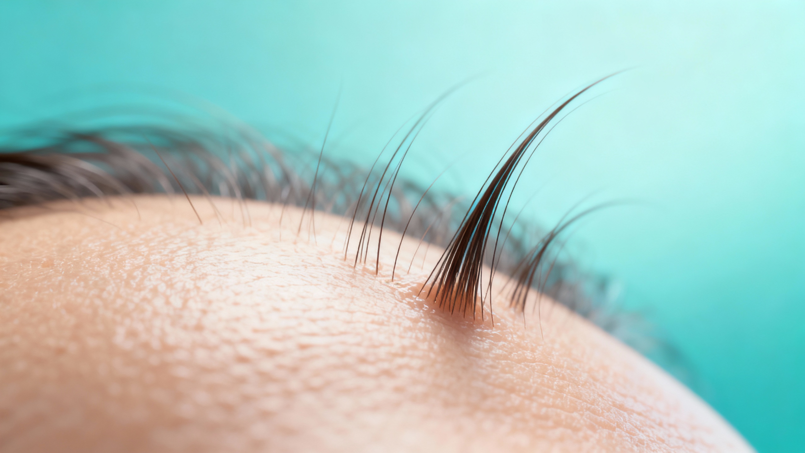 Featured image for Conquer the Itch: Coping with Seborrheic Dermatitis Like a Pro