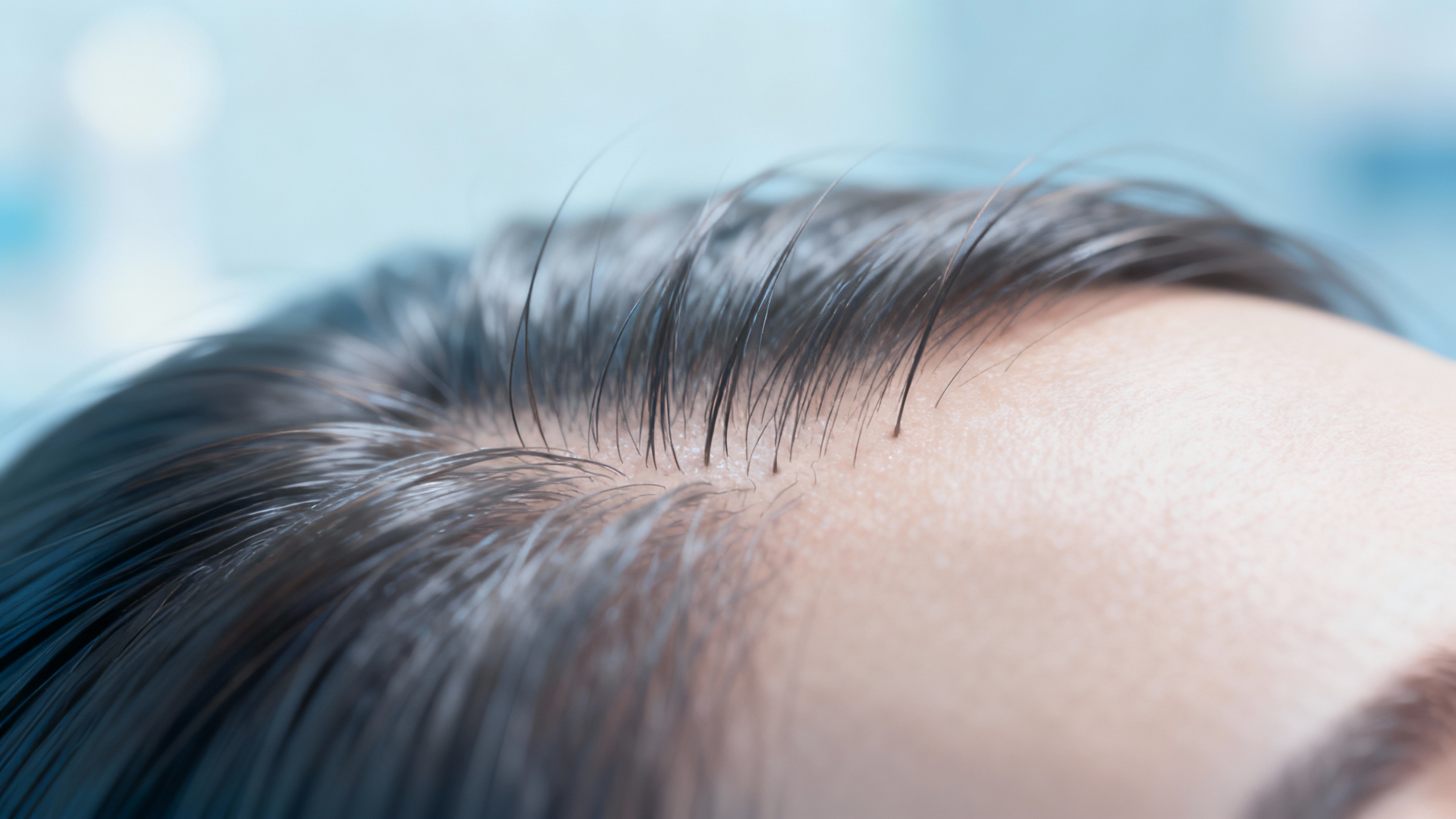 Featured image for Conquer Scalp Flakiness: Discover the Ultimate Relief Solutions